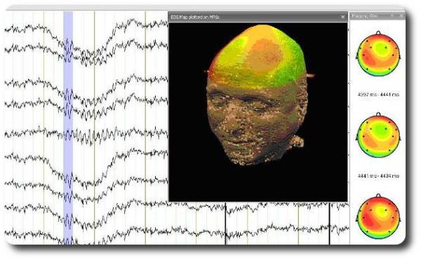 analyzer2_example2