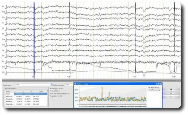 eeg_example